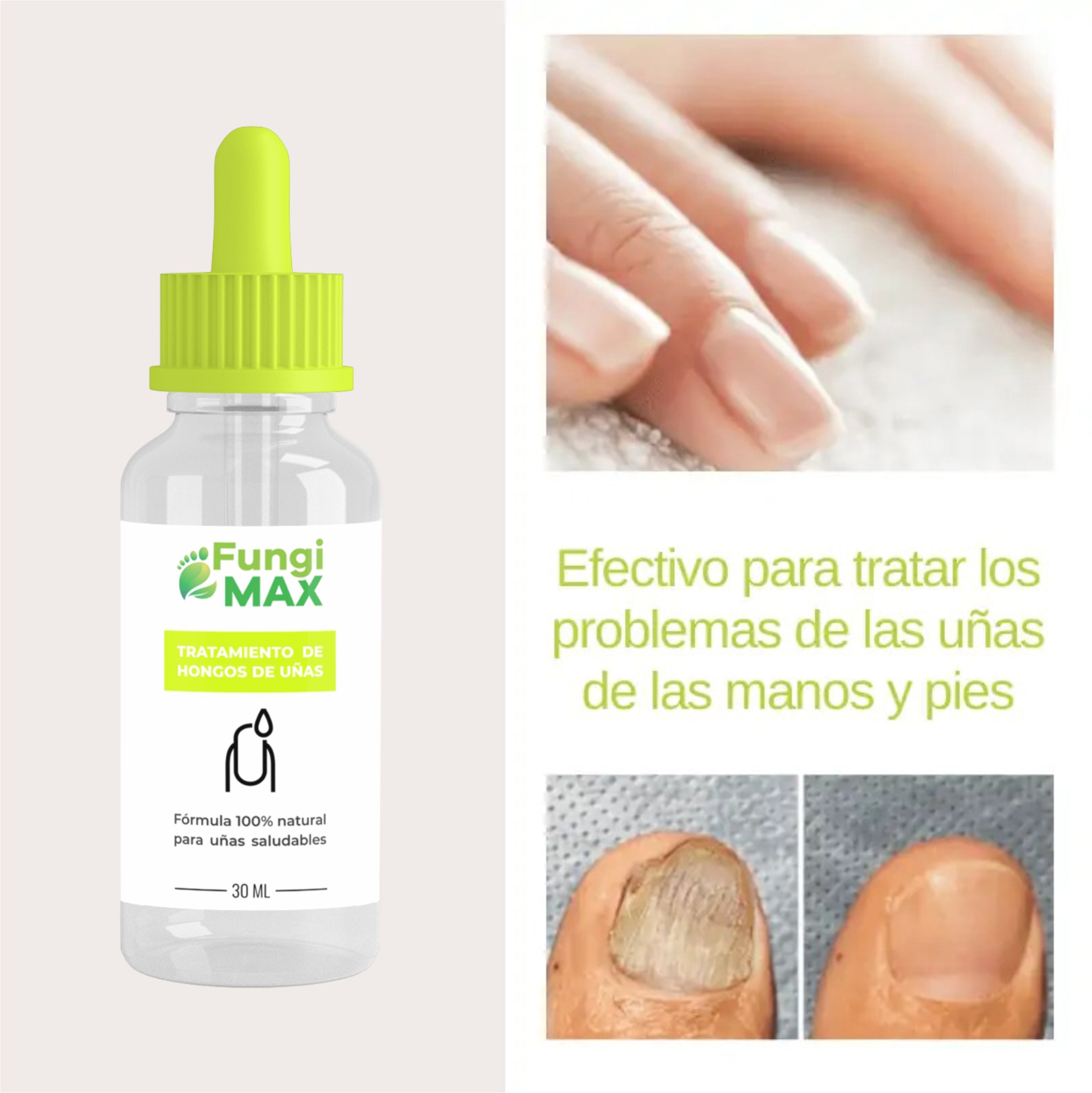 Sérum para Hongos de Uñas FungiMax