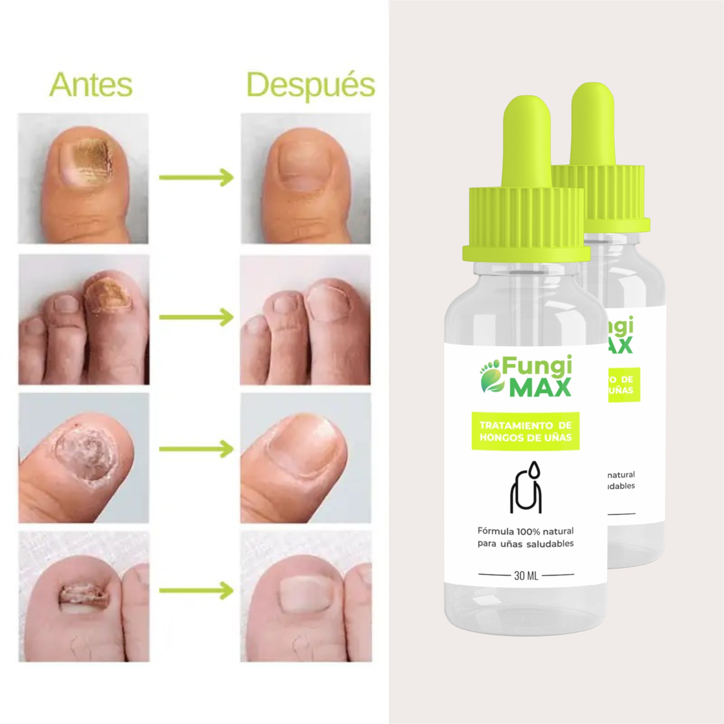 Sérum para Hongos de Uñas FungiMax