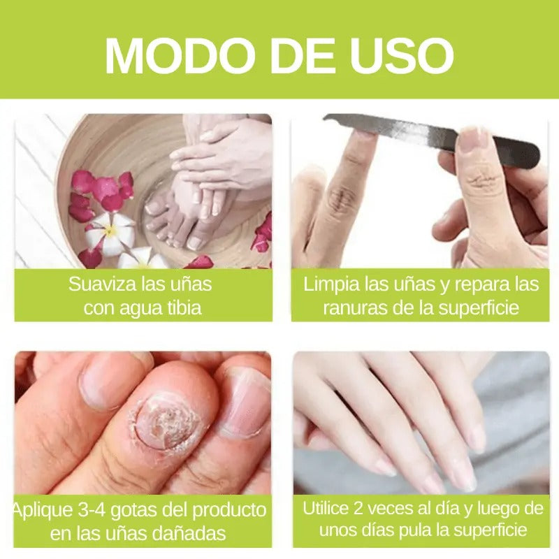 Sérum para Hongos de Uñas FungiMax