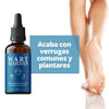 Wart Remover - Removedor de verrugas y lunares