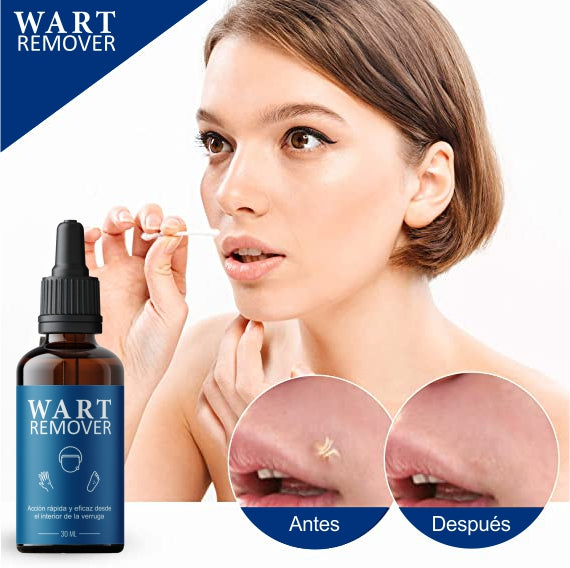 Wart Remover - Removedor de verrugas y lunares