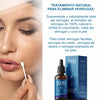 Wart Remover - Removedor de verrugas y lunares